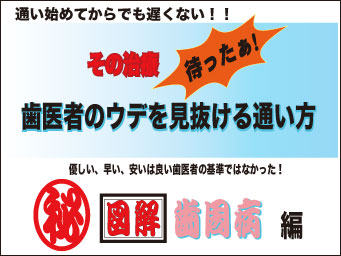 歯医者のウデを見抜ける通い方 歯周病偏