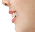 �� �ޥ˥奢��7