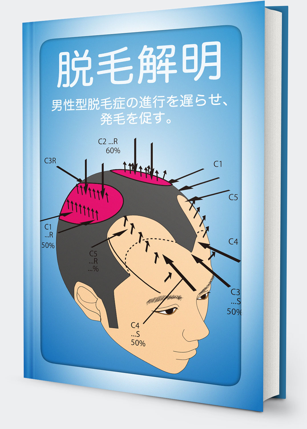 【脱毛解明】ハゲの真実、脱毛を送らせやがて発毛させる方法