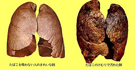 【全額返金保証】狂速のパーフェクト禁煙法〜1日3箱のヘビースモーカーも我慢しないで禁煙できた!たった1秒で成功する、知らないうちにやめられるダイエット禁煙法