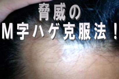 『サラリーマンの発毛・育毛体験談』　発毛、育毛でお悩みの方へ！脅威の発毛・育毛プログラム